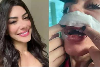 Mulher que teve dentes quebrados retira queixa e livra cantor de forr da priso em Manaus