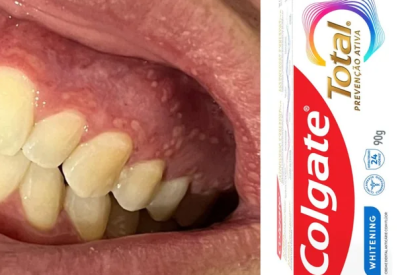 Anvisa volta a interditar pasta dental da Colgate